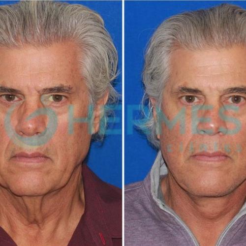 Before after photos of our patients 7